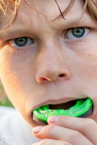 Young boy placing athletic mouthguard over his teeth