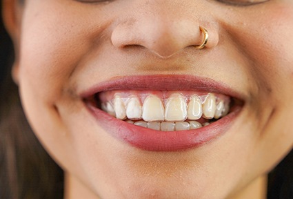 Closeup of woman smiling while wearing clear aligners