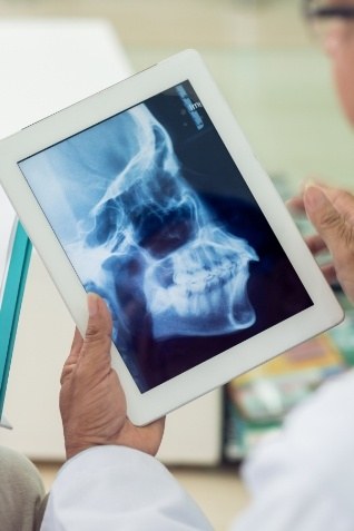 Person looking at x rays of jaws on tablet